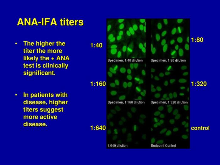 Titer investigated liver positive