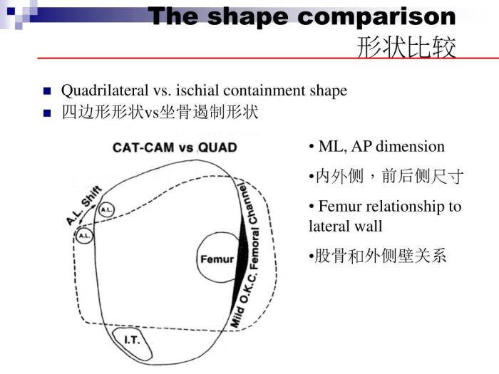 Quadrilateral socket vs ischial containment